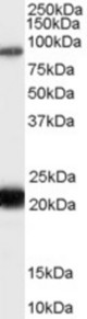 Antibody (0.3 ug/ml) staining of Human Thyroid lysate (35 ug protein in RIPA buffer). Primary incubation was 1 hour. Detected by chemiluminescence.