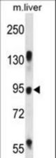 RASAL1 Antibody western blot of mouse liver tissue lysates (35 ug/lane). The RASAL1 antibody detected the RASAL1 protein (arrow).