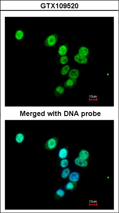 Immunofluorescence of paraformaldehyde-fixed A549 using RASAL1 antibody at 1:200 dilution.