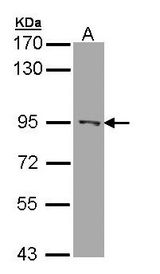 Sample (30 ug of whole cell lysate). A: A431 . 7.5% SDS PAGE. RASAL1 / RASAL antibody diluted at 1:1000