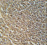 RASAL3 Antibody immunohistochemistry of formalin-fixed and paraffin-embedded human spleen tissue followed by peroxidase-conjugated secondary antibody and DAB staining.