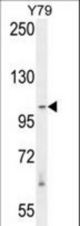RASAL3 Antibody western blot of Y79 cell line lysates (35 ug/lane). The RASAL3 antibody detected the RASAL3 protein (arrow).