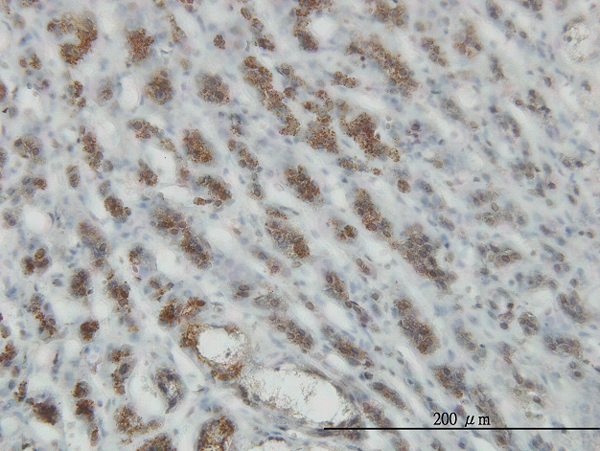 Immunoperoxidase of monoclonal antibody to RASEF on formalin-fixed paraffin-embedded human adrenal gland. [antibody concentration 3 ug/ml]