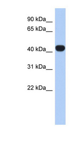 RASGEF1C antibody LS-C102686 Western blot of Fetal Heart lysate.