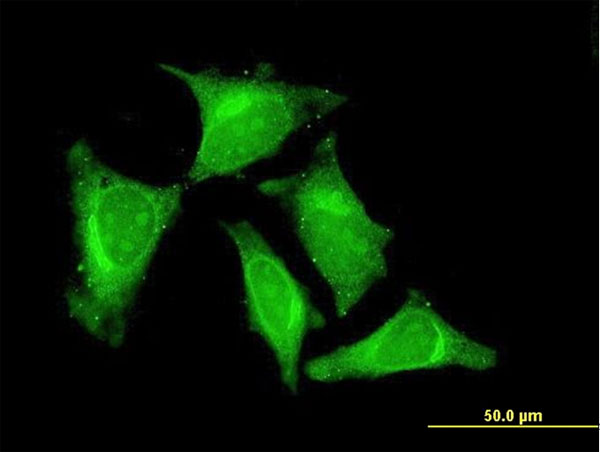 Immunofluorescence of monoclonal antibody to RASGEF1C on HeLa cell. [antibody concentration 10 ug/ml].