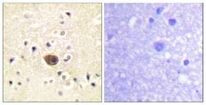 IHC of paraffin-embedded human brain tissue, using Ras-GRF1 (Ab-916) Antibody. The picture on the right is treated with the synthesized peptide.