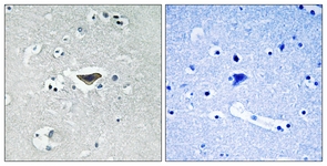 IHC of paraffin-embedded human brain, using Ras-GRF1 (Phospho-Ser916) Antibody. The sample on the right was incubated with synthetic peptide.
