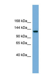 RASGRF1 antibody LS-C117271 Western blot of Fetal Brain lysate.