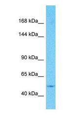 Western blot of RASGRF1 Antibody with human 786-0 Whole Cell lysate.