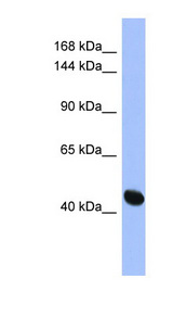 RASGRF1 antibody LS-C111936 Western blot of HepG2 cell lysate.