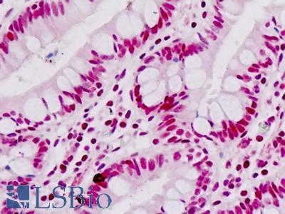 Human Small Intestine: Formalin-Fixed, Paraffin-Embedded (FFPE)