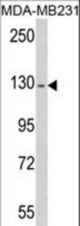 Western blot of RASGRF1 antibody (S929) in MDA-MB231 cell line lysates (35 ug/lane). RASGRF1 (arrow) was detected using the purified antibody.