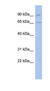 RASGRP2 antibody LS-C112261 Western blot of Fetal Brain lysate.