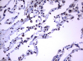 IHC of paraffin-embedded Human lung tissue using anti-RASGRP3 mouse monoclonal antibody.