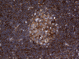 IHC of paraffin-embedded Human tonsil using anti-RASGRP3 mouse monoclonal antibody. (Heat-induced epitope retrieval by 10mM citric buffer, pH6.0, 120°C for 3min).