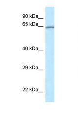 RASGRP4 antibody LS-C145724 Western blot of Jurkat Cell lysate. Antibody concentration 1 ug/ml.