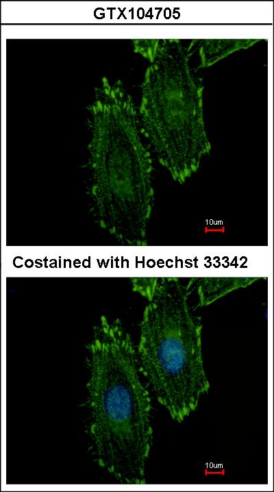 Immunofluorescence of methanol-fixed HeLa using RASGRP4 antibody at 1:500 dilution.