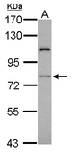 Sample (30 ug of whole cell lysate). A: Jurkat. 7.5% SDS PAGE. RASGRP4 antibody diluted at 1:1000.