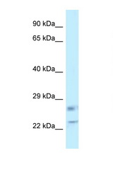 RASL11B antibody LS-C145790 Western blot of Placenta lysate. Antibody concentration 1 ug/ml.