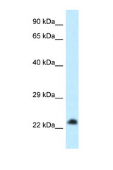 RASL11B antibody LS-C145789 Western blot of HeLa Cell lysate. Antibody concentration 1 ug/ml.