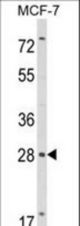 Western blot of RASL11B Antibody in MCF-7 cell line lysates (35 ug/lane). RASL11B (arrow) was detected using the purified antibody.