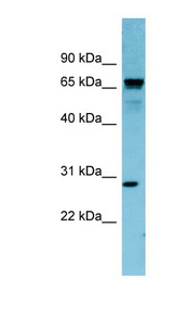 RASL12 antibody LS-C107538 Western blot of MCF7 cell lysate.