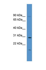 RASSF1 / RASSF1A antibody LS-C135582 Western blot of Fetal Lung lysate. Antibody concentration 1 ug/ml.