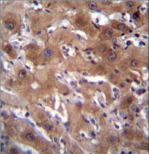 RASSF10 Antibody immunohistochemistry of formalin-fixed and paraffin-embedded human liver tissue followed by peroxidase-conjugated secondary antibody and DAB staining.