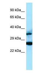 RASSF2 antibody Western Blot of Placenta.