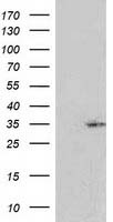 HEK293T cells were transfected with the pCMV6-ENTRY control (Left lane) or pCMV6-ENTRY RASSF5 (Right lane) cDNA for 48 hrs and lysed. Equivalent amounts of cell lysates (5 ug per lane) were separated by SDS-PAGE and immunoblotted with anti-RASSF5.
