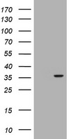 HEK293T cells were transfected with the pCMV6-ENTRY control (Left lane) or pCMV6-ENTRY RASSF5 (Right lane) cDNA for 48 hrs and lysed. Equivalent amounts of cell lysates (5 ug per lane) were separated by SDS-PAGE and immunoblotted with anti-RASSF5.