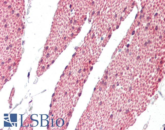 Human Small Intestine: Formalin-Fixed, Paraffin-Embedded (FFPE)