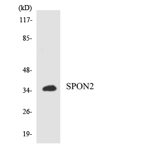 Western blot of the lysates from K562 cells using RASSF6 antibody.