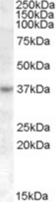 Antibody (1 ug/ml) staining of Jurkat cell lysate (35 ug protein in RIPA buffer). Primary incubation was 1 hour. Detected by chemiluminescence.