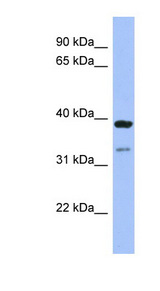 RASSF7 antibody LS-C107492 Western blot of Fetal Stomach lysate.