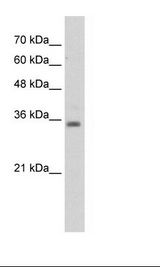 Jurkat Cell Lysate