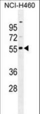 RASSF8 antibody western blot of NCI-H460 cell line lysates (35 ug/lane). The RASSF8 antibody detected the RASSF8 protein (arrow).