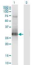 Western Blot analysis of PRRX1 expression in transfected 293T cell line by PRRX1 monoclonal antibody (M01), clone 1E2.Lane 1: PRRX1 transfected lysate (Predicted MW: 24.4 KDa).Lane 2: Non-transfected lysate.