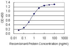 Detection limit for recombinant GST tagged PRRX1 is 0.03 ng/ml as a capture antibody.