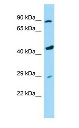 RASSF9 / P-CIP1 antibody Western Blot of U937 Whole Cell lysates. Antibody Dilution: 1.0 ug/ml. Antibody dilution: 1 ug/ml.