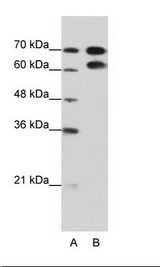 A: Marker, B: HepG2 Cell Lysate
