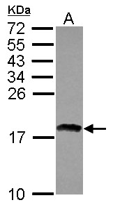 Sample (30 ug of whole cell lysate) A: IMR32 12% SDS PAGE RAX2 / RAXL1 antibody diluted at 1:1000