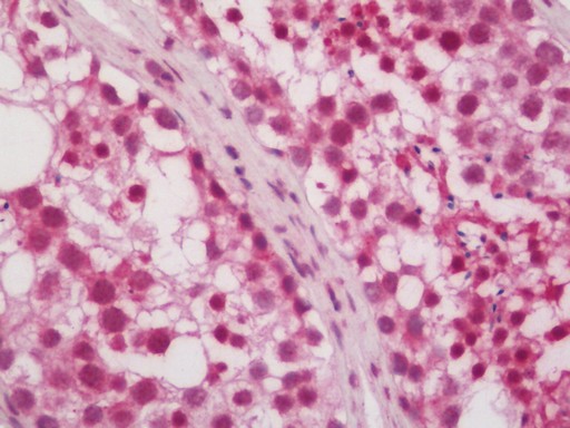Human Testis: Formalin-Fixed, Paraffin-Embedded (FFPE)