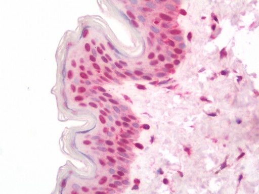 Human Skin: Formalin-Fixed, Paraffin-Embedded (FFPE)