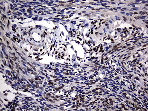 IHC of paraffin-embedded Human endometrium tissue using anti-PRRX1 mouse monoclonal antibody. (Heat-induced epitope retrieval by 10mM citric buffer, pH6.0, 120°C for 3min).