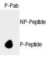 Dot blot of anti-hRb-S788 Phospho-specific antibody on nitrocellulose membrane. 50ng of nonphospho-peptide or phospho-peptide were adsorbed on their respective dots. Antibody working concentration was 0.5ug per ml.