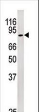 Western blot of anti-Rb antibody in Sk-Br-3 cell line lysate (35 ug/lane). Rb(arrow) was detected using the purified antibody.
