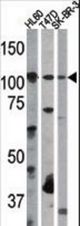 The anti-RB antibody is used in Western blot to detect RB in, from left to right, HL60, T47D, and SK-BR-3 tissue lysates.