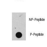 Dot blot of anti-Phospho-RB-S608 Antibody on nitrocellulose membrane. 50ng of Phospho-peptide or Non Phospho-peptide per dot were adsorbed. Antibody working concentrations are 0.5ug per ml.