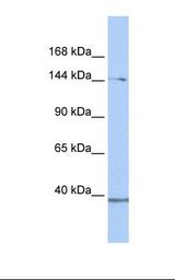 293T cell lysate. Antibody concentration: 1.0 ug/ml. Gel concentration: 6-18%.
